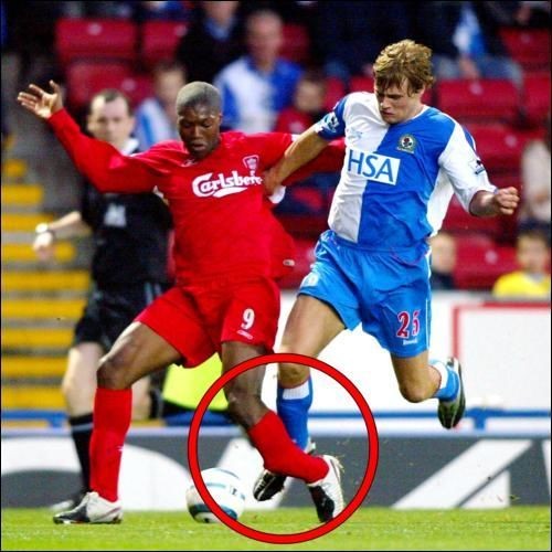 Tiền đạo Djibril Cisse là một trong những cầu thủ bóng đá đen đủi nhất thế giới khi anh từng 2 lần bị gãy chân. Tháng 10/2004 , khi còn khoác áo CLB Liverpool, Cisse đã bị gãy chân trái sau pha tranh bóng với cầu thủ Jay McEveley của Blackburn Rovers.